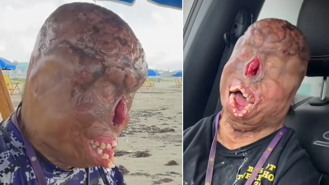 Ajude o Bruno a Reconstruir Sua Esperança